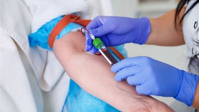 KBC Sestre milosrdnice počinje validaciju domaće proizvodnje CAR-T stanične imunoterapije