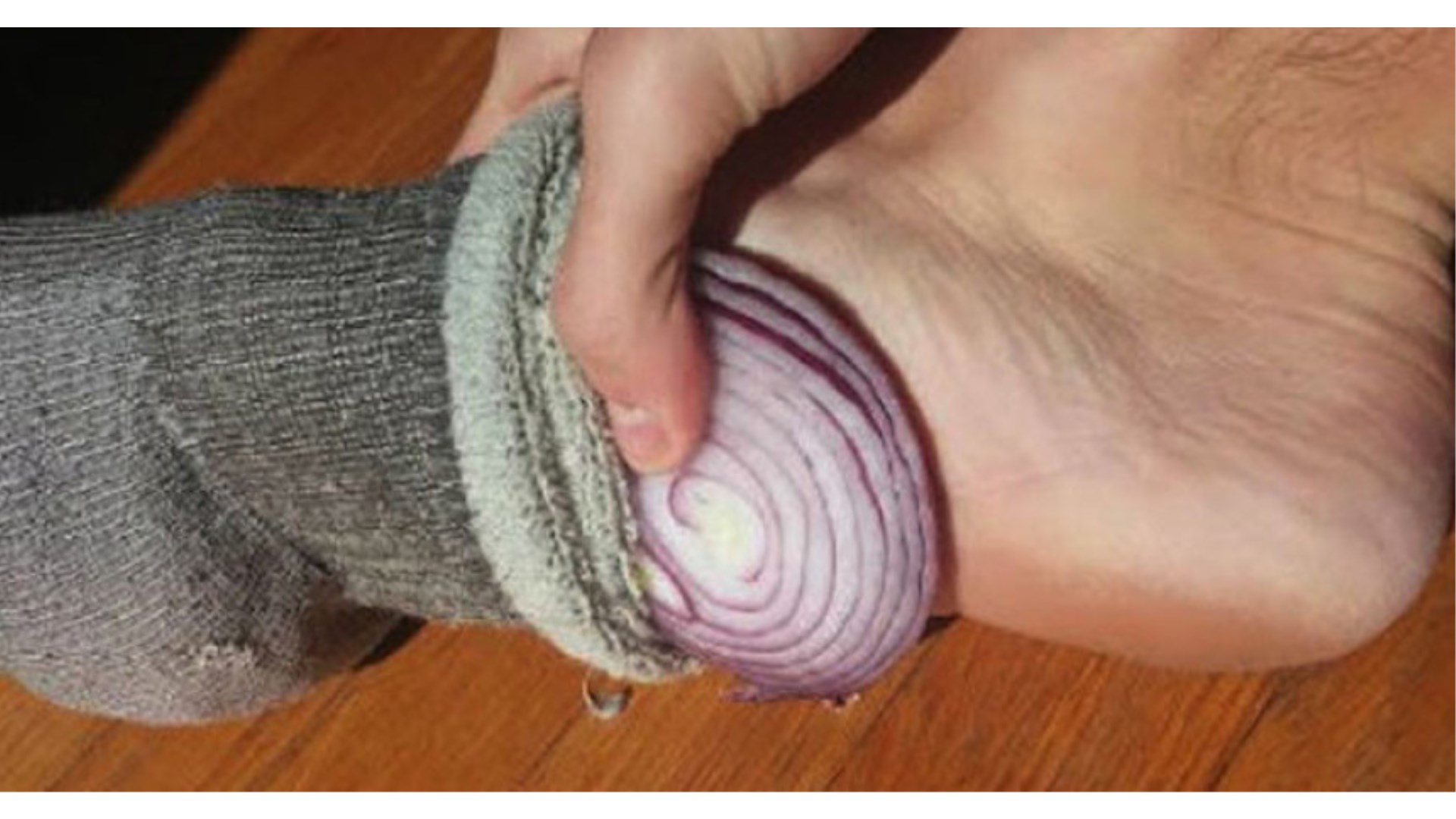 Jedna noć s lukom u čarapi čini čuda! Evo koje zdravstvene tegobe nestaju kao s nokta