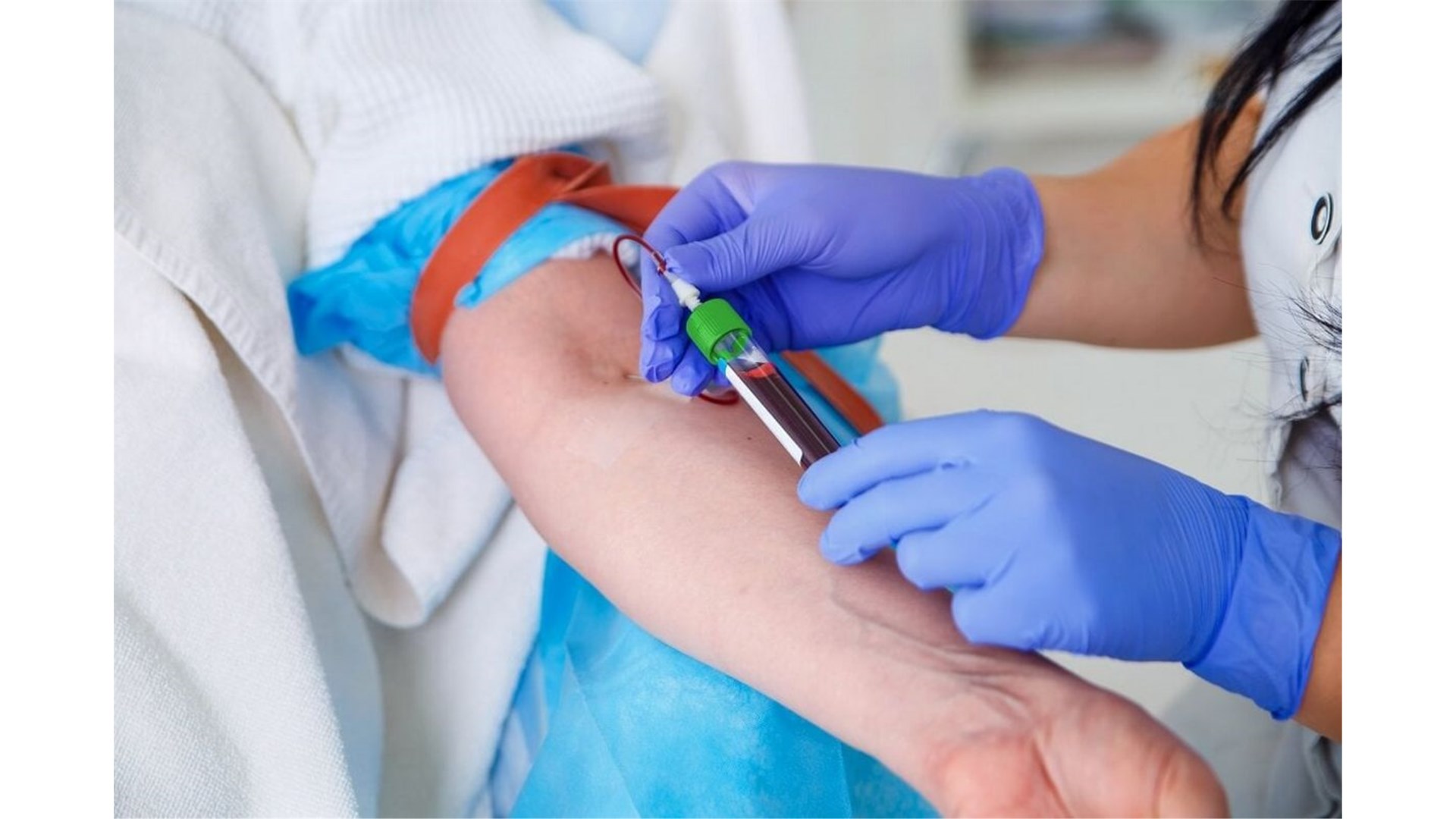 KBC Sestre milosrdnice počinje validaciju domaće proizvodnje CAR-T stanične imunoterapije